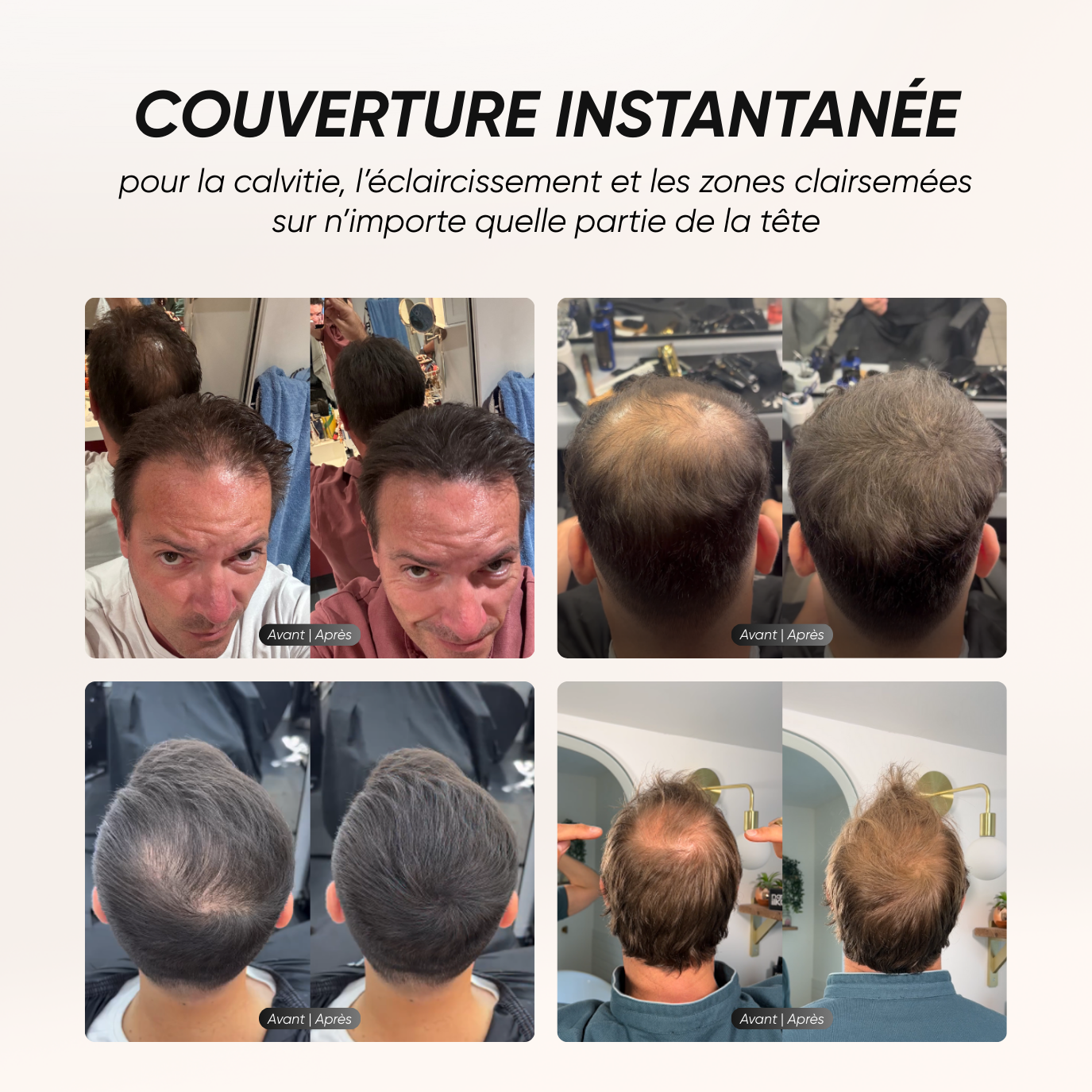 Camouflage capillaire + Sérum repousse et anti-chute