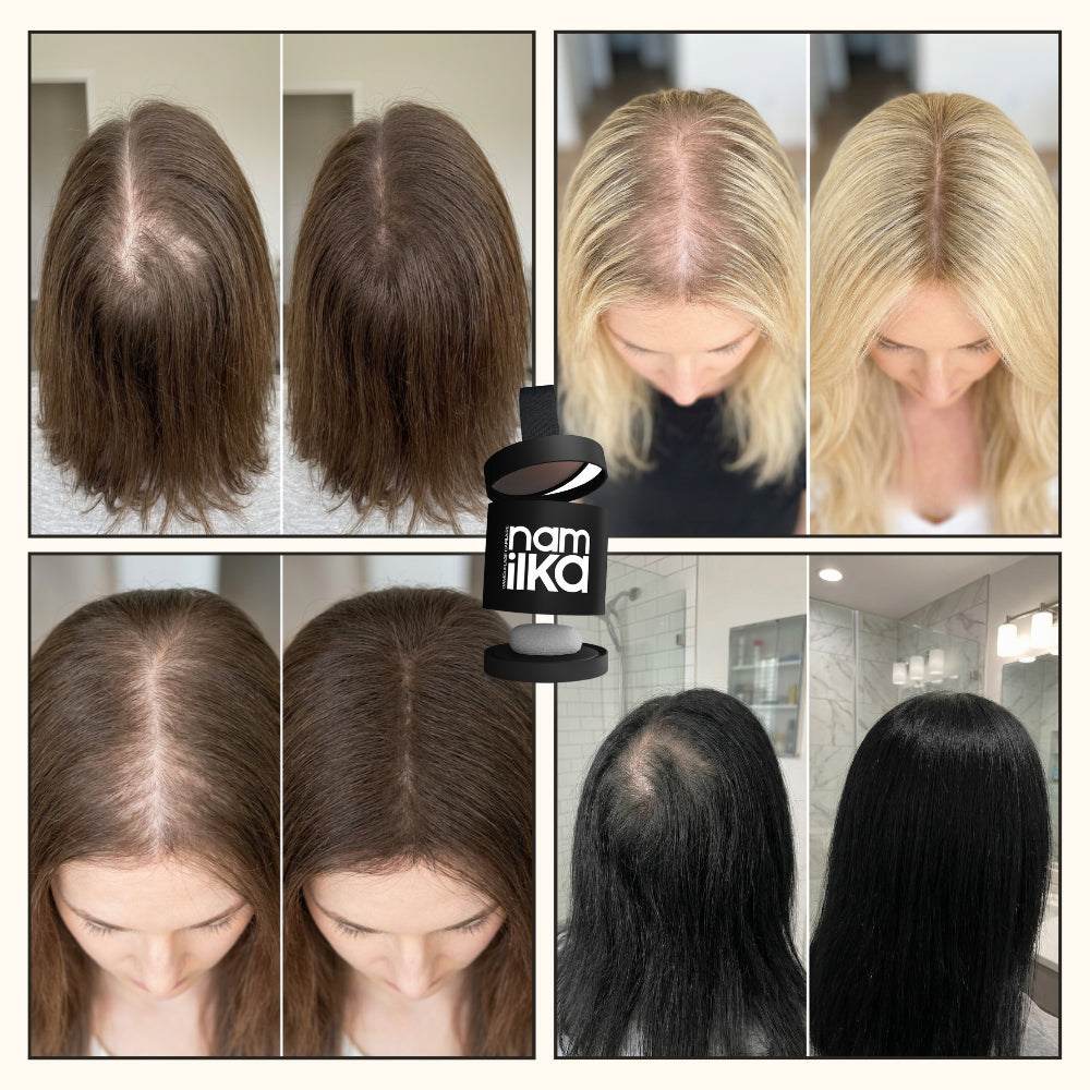 Hair camouflage | Women