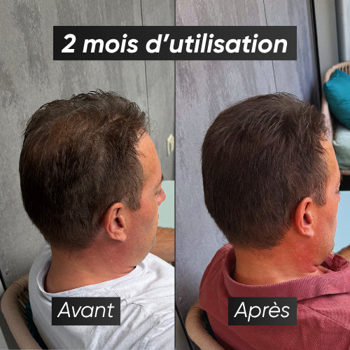 Pack - Chauve Qui Peut