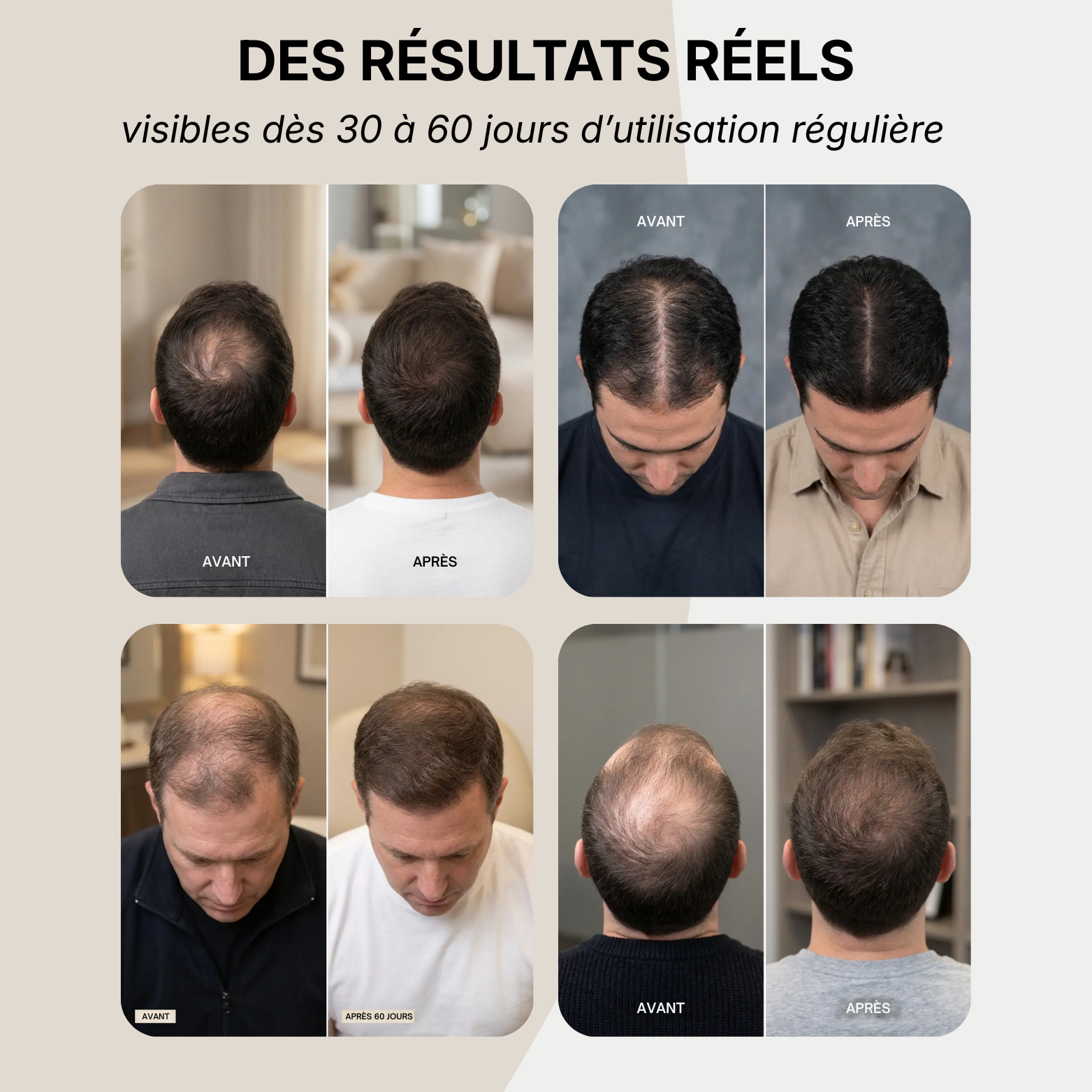 Shampoing Anti-Chute & Repousse